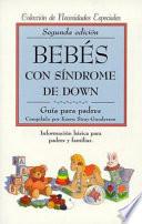 Bebés con sindrome de Down