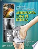 Libro Dominio de Técnicas Ortopédicas: Artroplastía Total de Rodilla