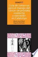 Guías de consenso para el manejo del cáncer de próstata resistente a castración en Catalunya