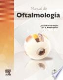 Manual de oftalmología