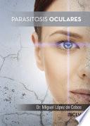 Parasitosis oculares